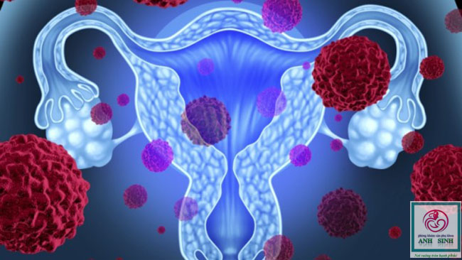 Ung Thư Cổ Tử Cung và HPV