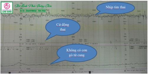 Đánh giá sức khỏe thai nhi