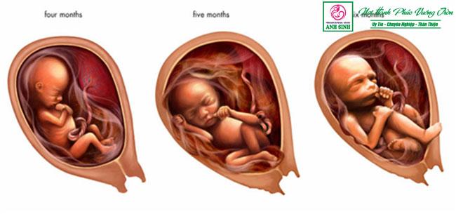 Đa thai - những điều mẹ bầu cần biết