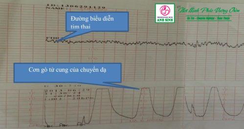 Đánh giá sức khỏe thai nhi