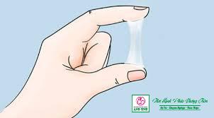 Điều trị viêm lộ tuyến cổ tử cung tại Nghệ An