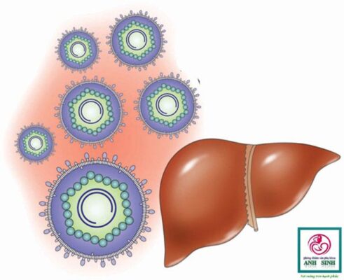 Bệnh viêm gan B và thai nghén những bà mẹ nên quan tâm