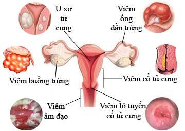 Siêu âm phụ khoa tại Vinh, Nghệ An Siêu âm phụ khoa tại Vinh, Nghệ An