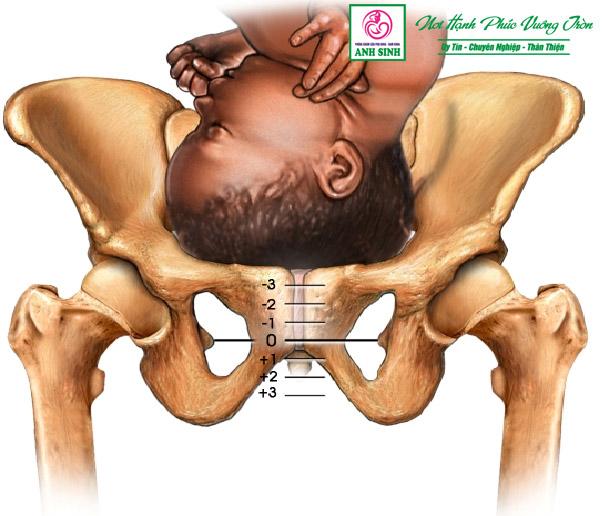 các yếu tố tiên lượng cuộc đẻ