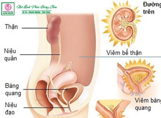 nhiễm trùng tiết niệu khi mang thai