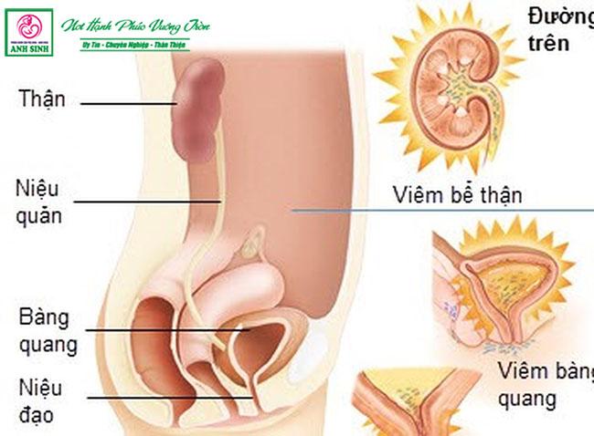 nhiễm trùng tiết niệu khi mang thai