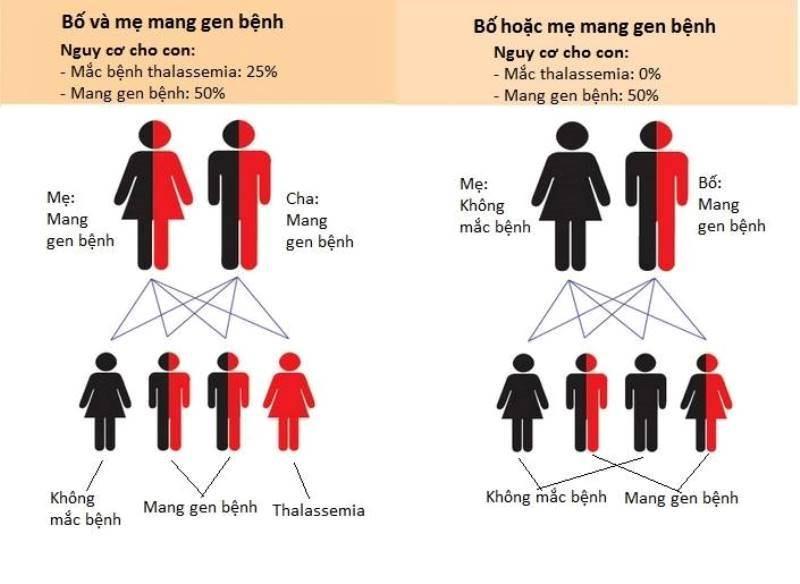 Xét nghiệm bệnh tan máu bẩm sinh tại Nghệ An