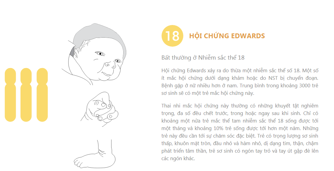 xét nghiệm sàng lọc trước sinh NIPT