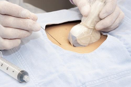 chuẩn đoán dị tật bẩm sinh