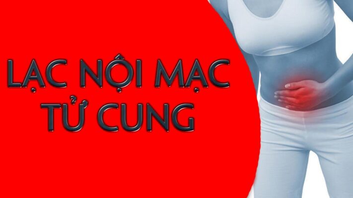 điều trị lạc nội mạc tử cung