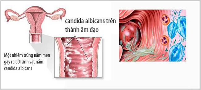 Vô sinh nữ giới - Không sao! Đã có phòng khám Anh Sinh