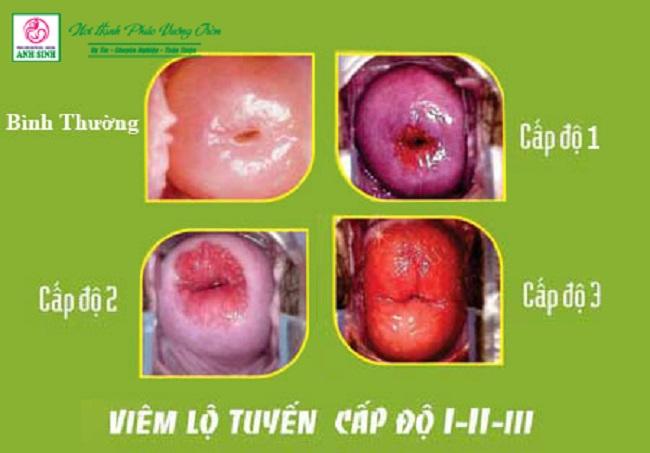 phòng khám sản  phụ khoa anh sinh