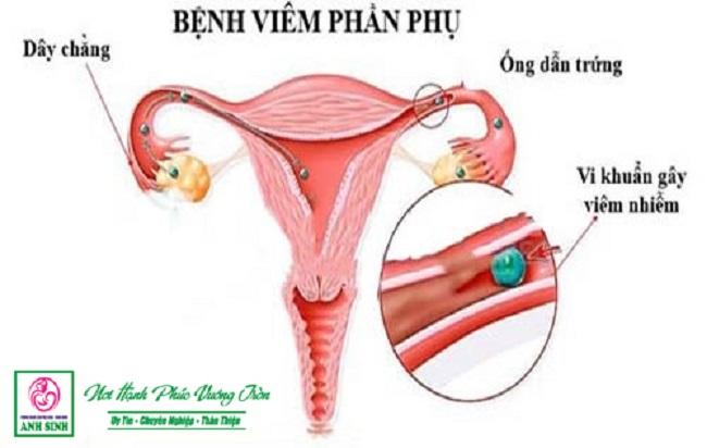 phòng khám sản phụ khoa anh sinh