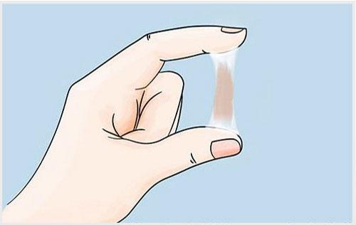 Những điều cần biết khi  huyết trắng có màu nâu 