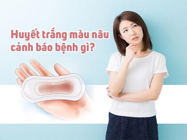 Những điều cần biết khi  huyết trắng có màu nâu 