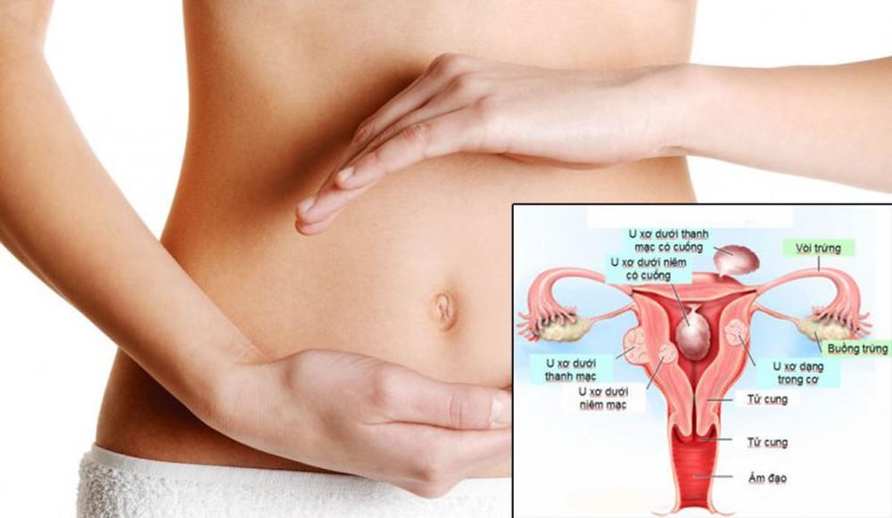 Các bệnh phụ khoa nguy hiểm