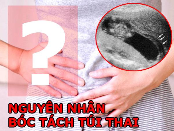 bóc tách túi thai 3