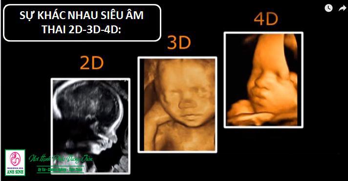 siêu âm thai 4D tại Vinh