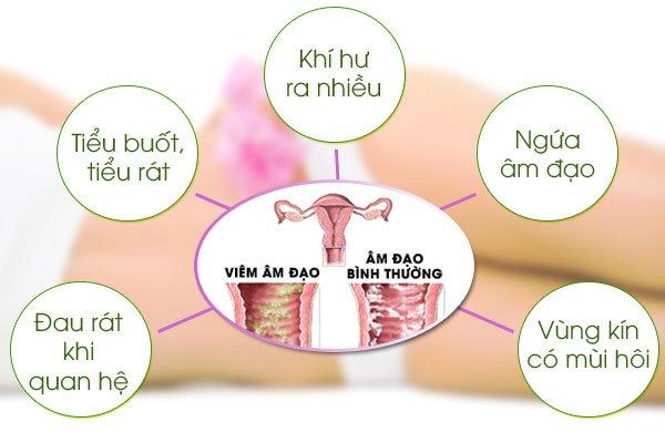 điều trị vô sinh nữ tại Nghệ An