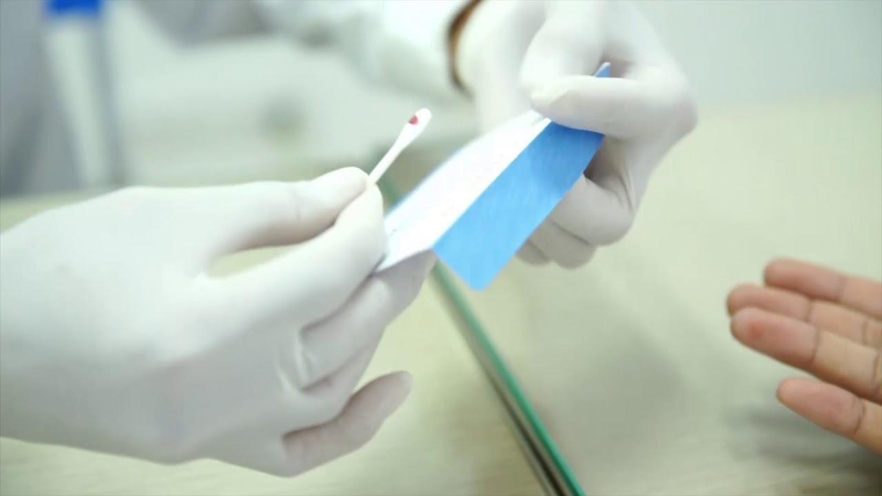 xét nghiệm ADN cần những gì?