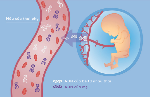 Xét nghiệm sàng lọc dị tật thai nhi không xâm lấn