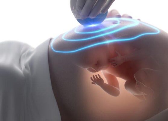 xét nghiệm sàng lọc trước sinh