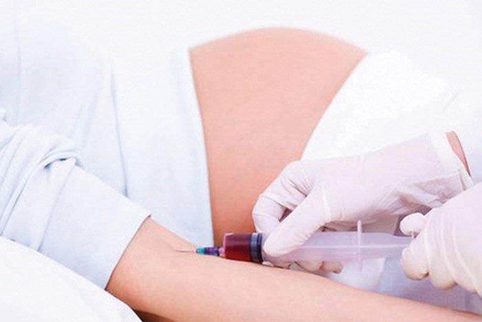 sàng lọc trước sinh không xâm lấn ( NIPT) tại Nghệ An