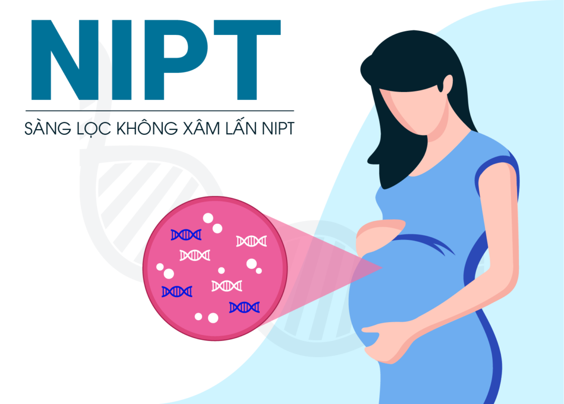 sàng lọc trước sinh tại Vinh
