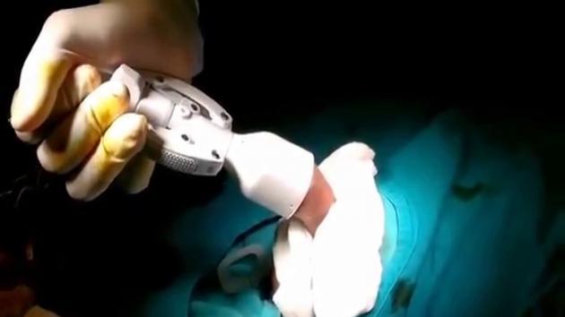 cắt bao quy đầu tai Vinh