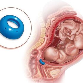 phòng khám sản phụ khoa tại Vinh